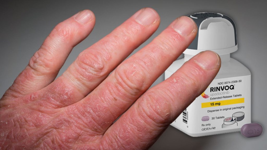 Цена Ринвок 15 мг в России